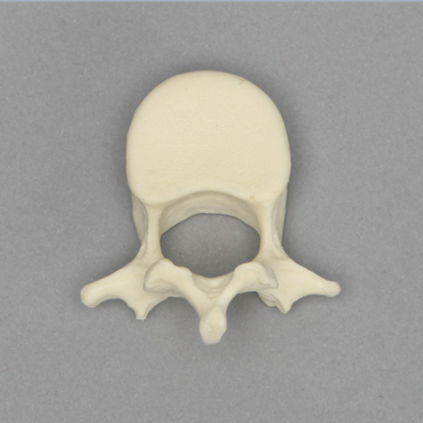 Vertebra, L2, Pediatric, Solid Foam