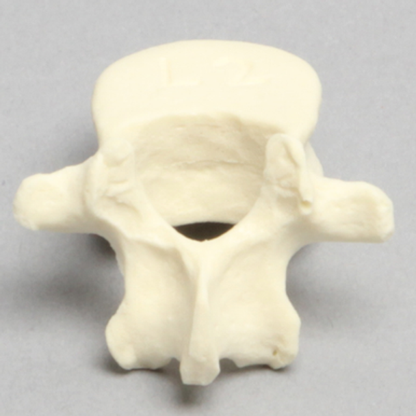 Vertebra, L2, Pediatric, Solid Foam