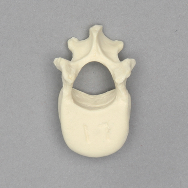 Vertebra, L1, Pediatric, Solid Foam