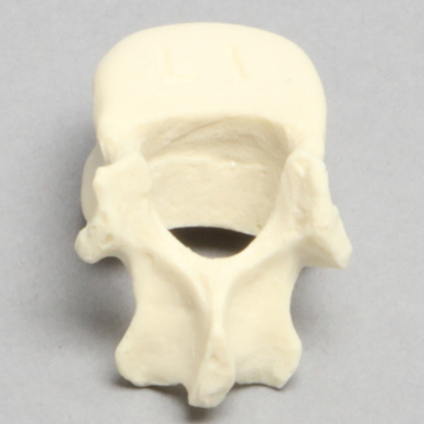 Vertebra, L1, Pediatric, Solid Foam