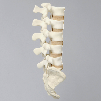 Spine, Lumbar with Flat Back Pathology, Foam Cortical