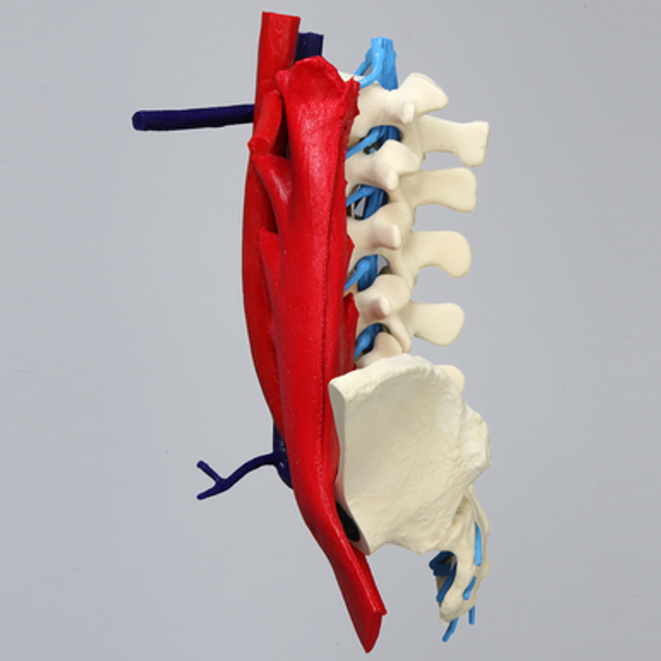 Spine, Lumbar, Left Iliac Crest, with Aorta, Vena Cava, Left Side Psoas, and Nerve Roots, Foam Cortical