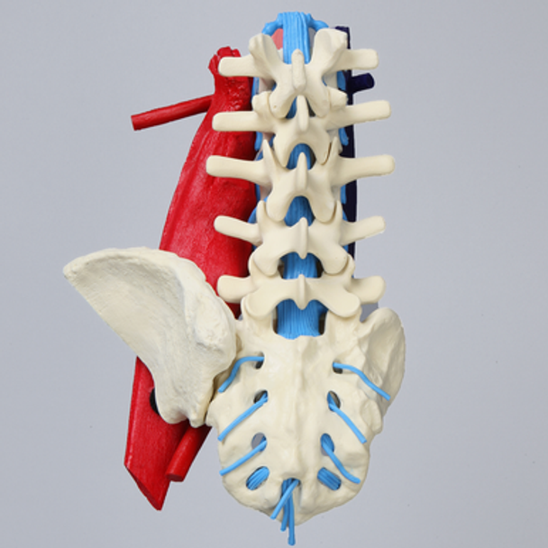 Spine, Lumbar, Left Iliac Crest, with Aorta, Vena Cava, Left Side Psoas, and Nerve Roots, Foam Cortical