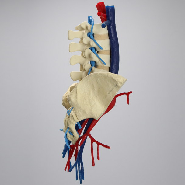 Spine, Lumbar, Iliac Crests with Aorta, Vena Cava, and Nerve Roots, Foam Cortical