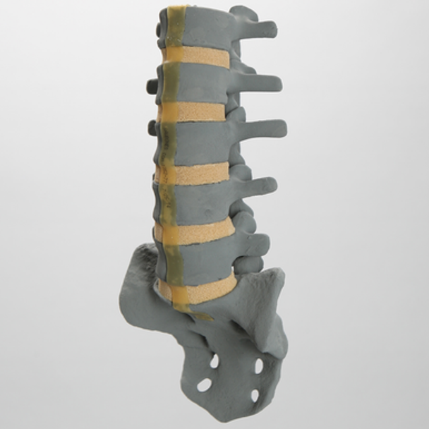 Spine, Lumbar, L1-Sacrum, Anterior and Posterior Ligaments, Radiopaque