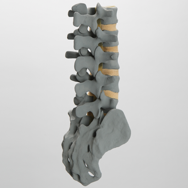 Spine, Lumbar, L1-Sacrum, Anterior and Posterior Ligaments, Radiopaque