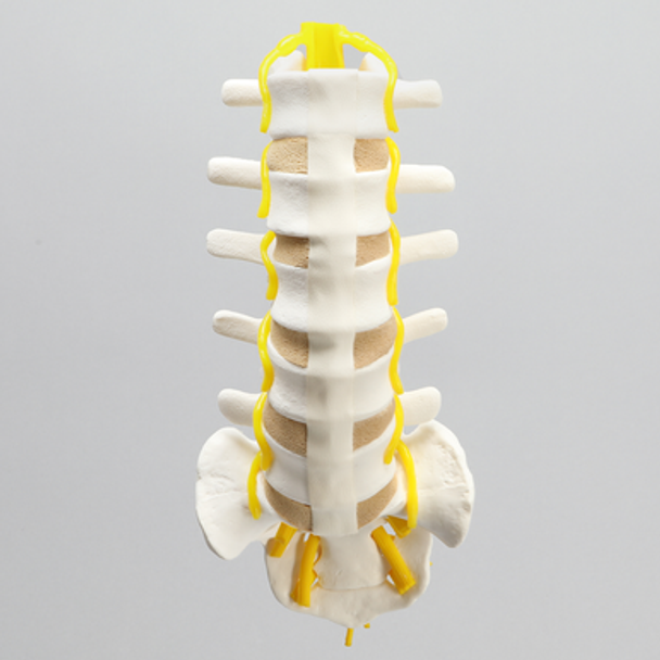 Spine, Lumbar with Yellow Nerve Roots, Foam Cortical
