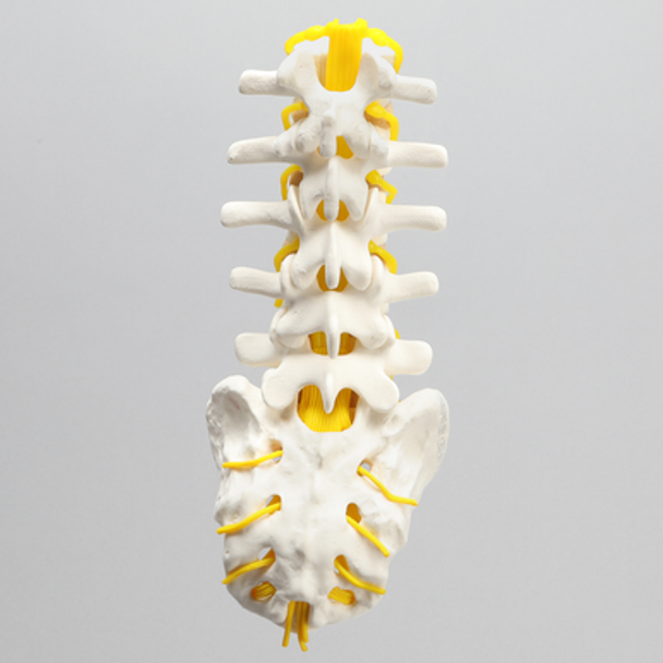 Spine, Lumbar with Yellow Nerve Roots, Foam Cortical