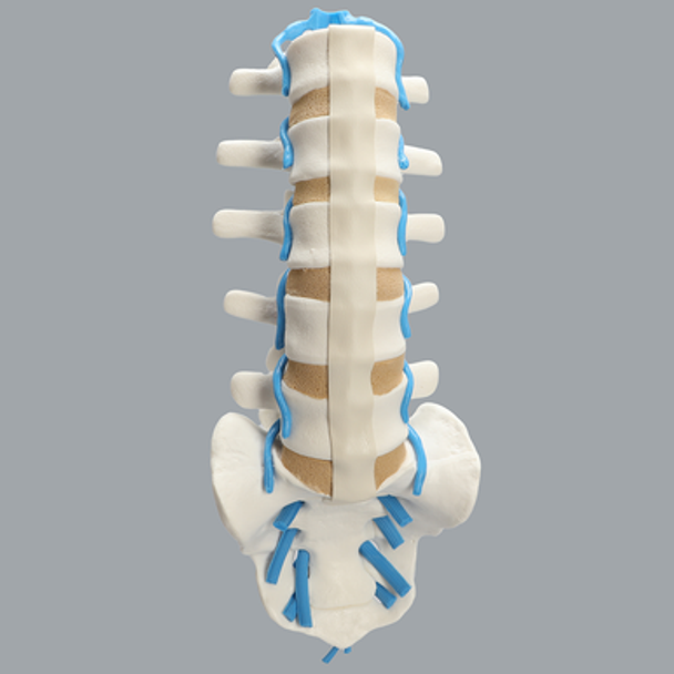 Spine, Lumbar with Blue Nerve Roots, Foam Cortical