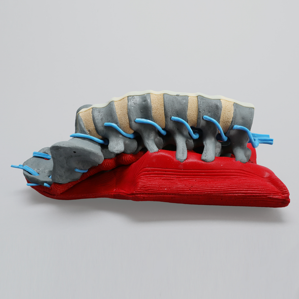 Spine, L1-Sacrum, Lumbar with Muscles and Nerve Roots, Radiopaque