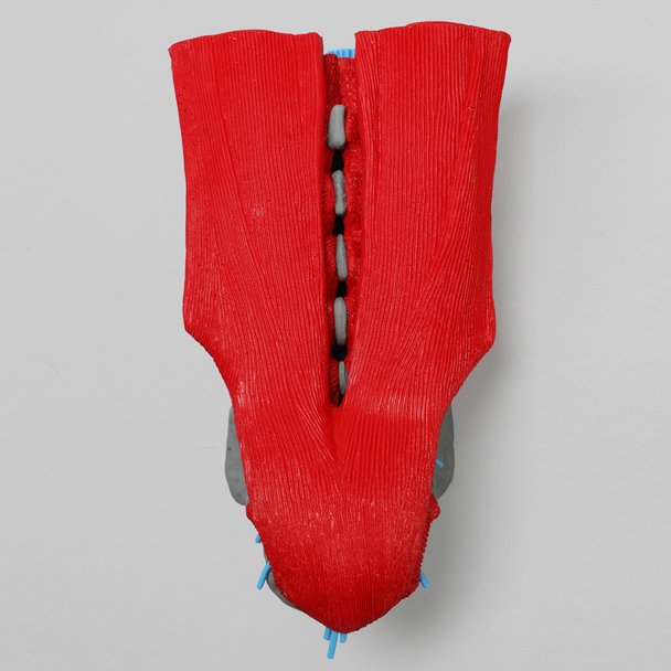 Spine, L1-Sacrum, Lumbar with Muscles and Nerve Roots, Radiopaque
