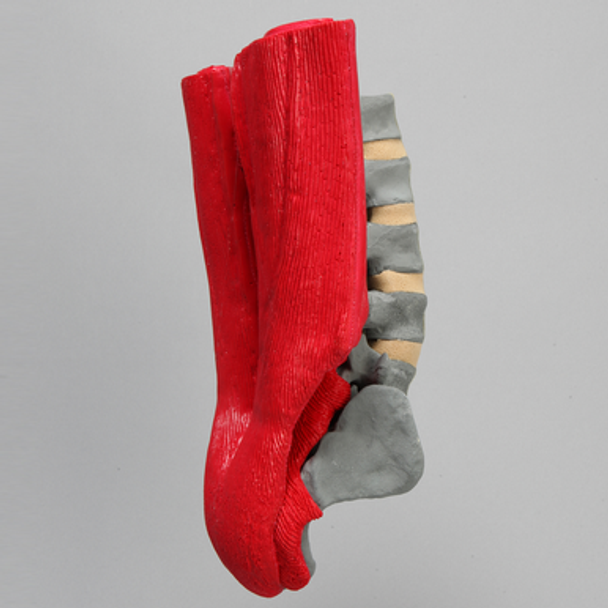 Spine, L1-Sacrum, Lumbar with Muscles, Radiopaque