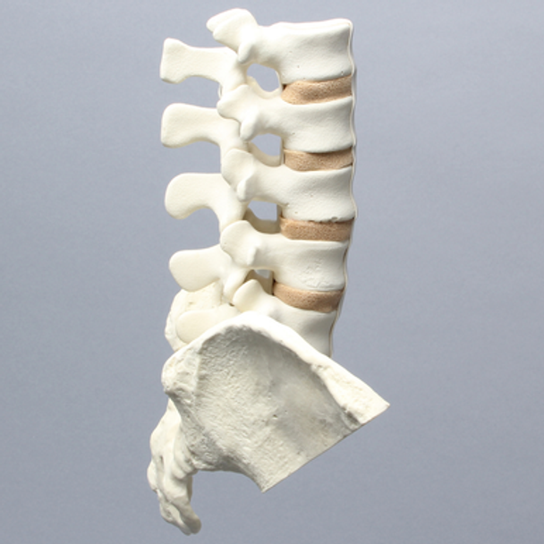 Spine, Lumbar, with Iliac Crests, Foam Cortical