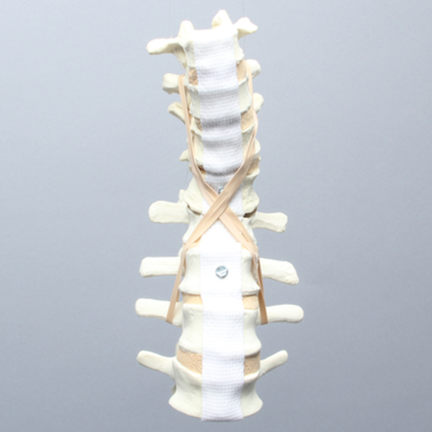 Spine, T9-L4, with L1 Burst, Foam Cortical
