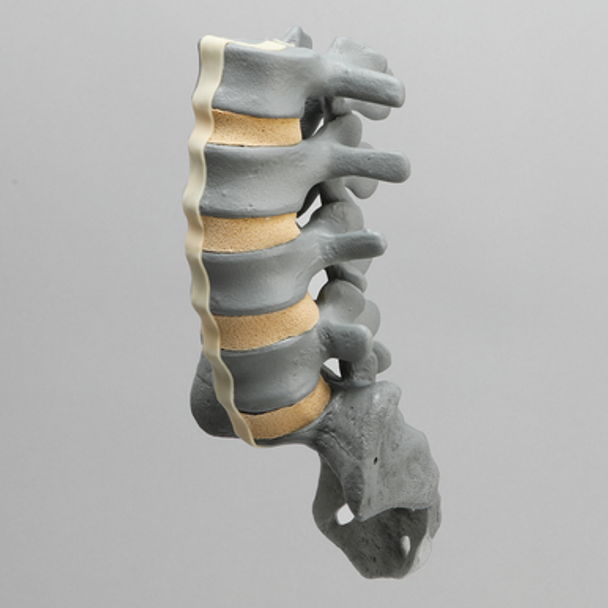 Spine, Lumbar, L2-Sacrum, Radiopaque