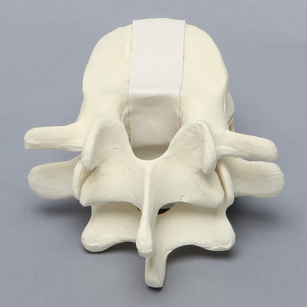 Lumbar Vertebrae, L4-L5, Foam Cortical