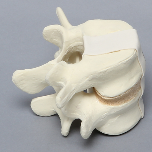 Lumbar Vertebrae, L4-L5, Foam Cortical
