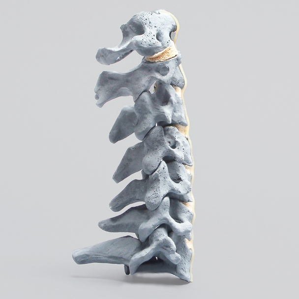 Spine, Cervical , with Anterior Ligament, Radiopaque