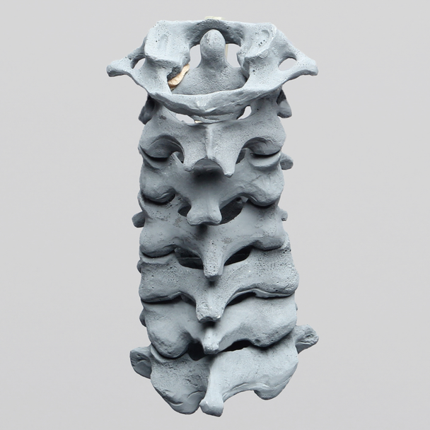 Spine, Cervical , with Anterior Ligament, Radiopaque