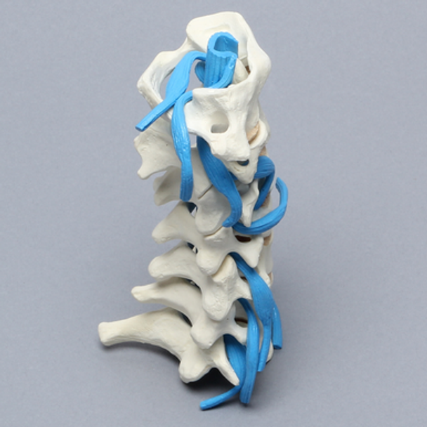 Spine, Cervical, with Nerve Roots, Foam Cortical