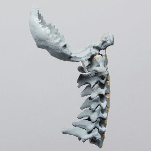 Spine, Cervical, with Occipital, Radiopaque