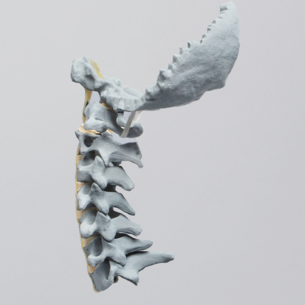 Spine, Cervical, with Occipital, Radiopaque