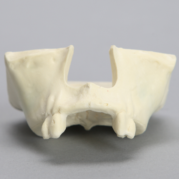 Maxilla with Mucosa