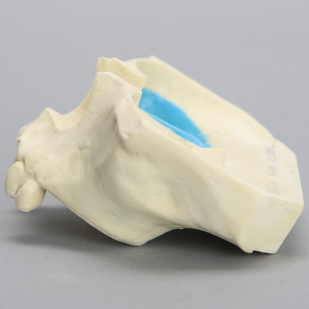Maxilla with Mucosa