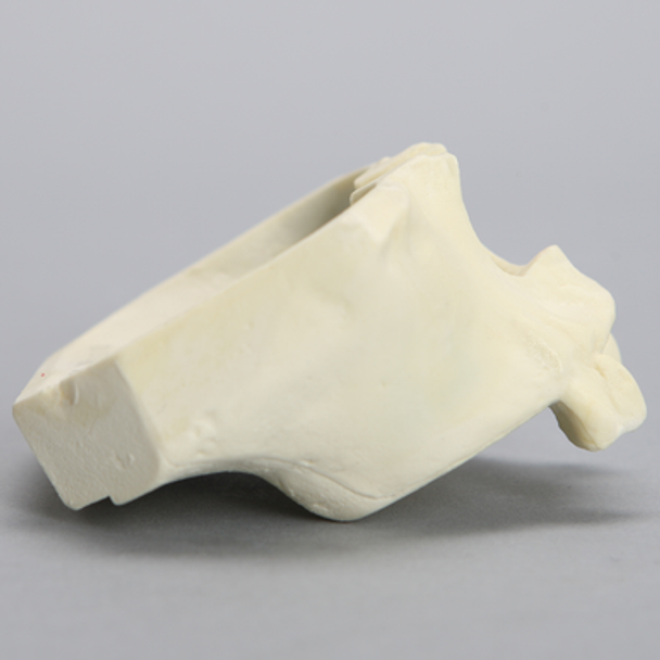 Maxilla with Mucosa