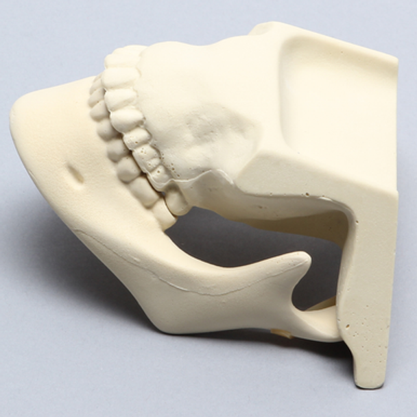 Mandible with Maxilla