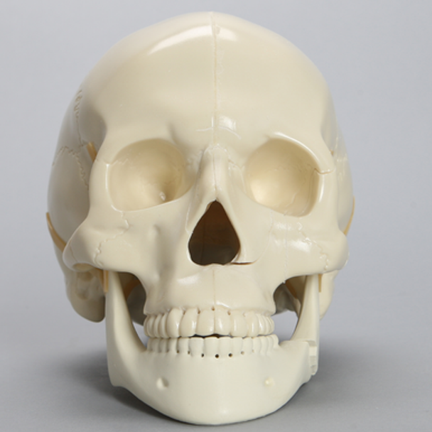 Skull, Full, With Multiple Fractures