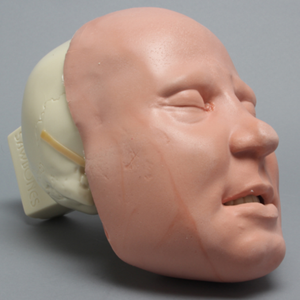 Skull, Full, With Fractures and Soft-Tissue Face