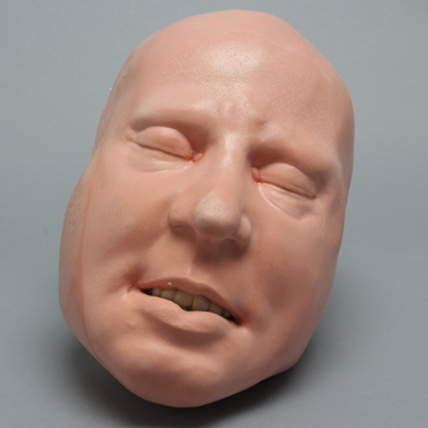Skull, Full, With Fractures and Soft-Tissue Face