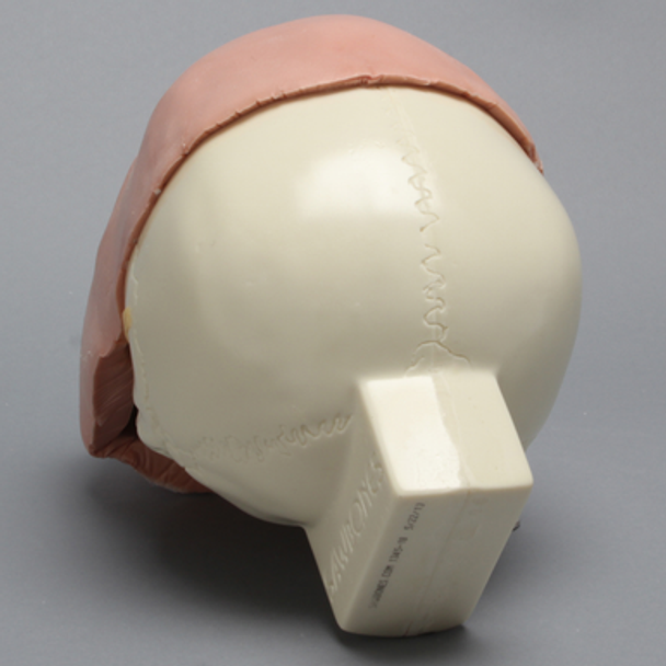 Skull, Full, With Fractures and Soft-Tissue Face