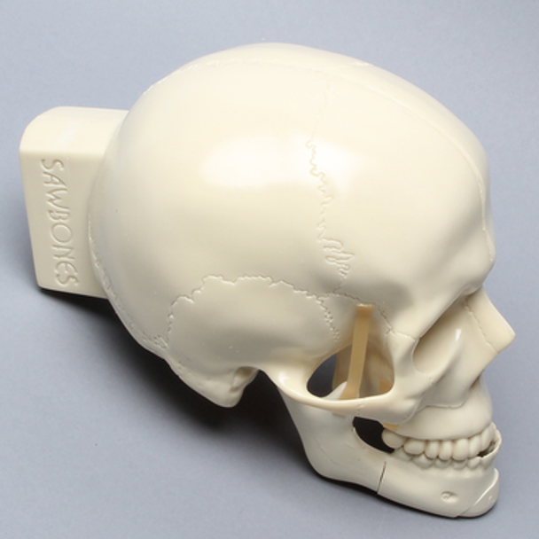 Skull, Full, With Le Fort I Fracture, Sagittal Split, and Genioplasty