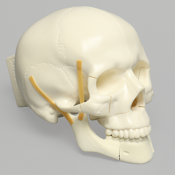 Skull, Full, with All Le Fort Fractures, Solid Foam