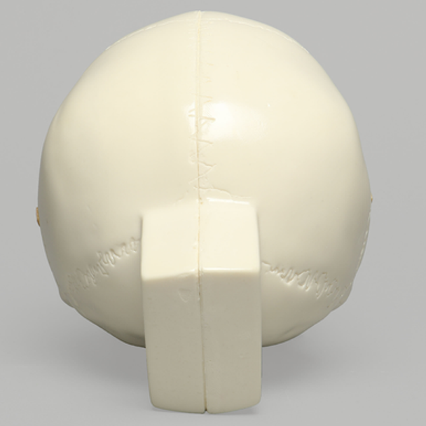 Skull, Full, with All Le Fort Fractures, Solid Foam