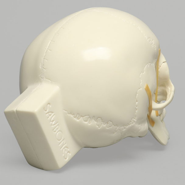 Skull, Full, with All Le Fort Fractures, Solid Foam