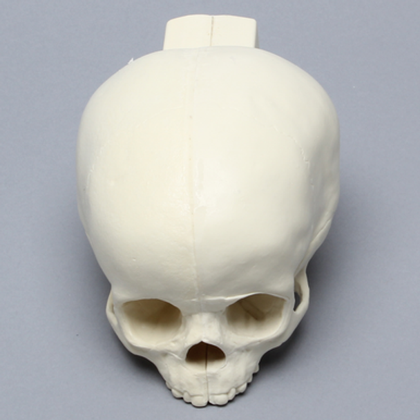 Skull, Pediatric, With Vise Attachment