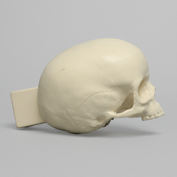 Skull, Pediatric, With Vise Attachment