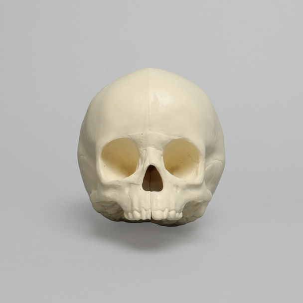 Skull, Pediatric, With Vise Attachment