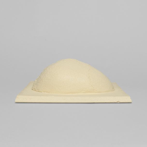 Skull Cap with Dura and Soft Tissue