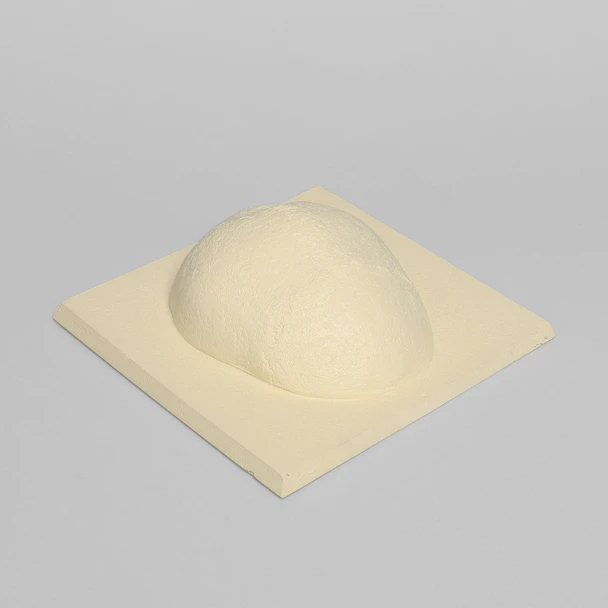 Skull Cap with Dura and Soft Tissue