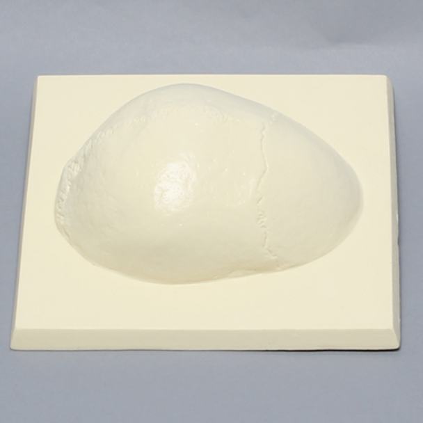 Skull Cap