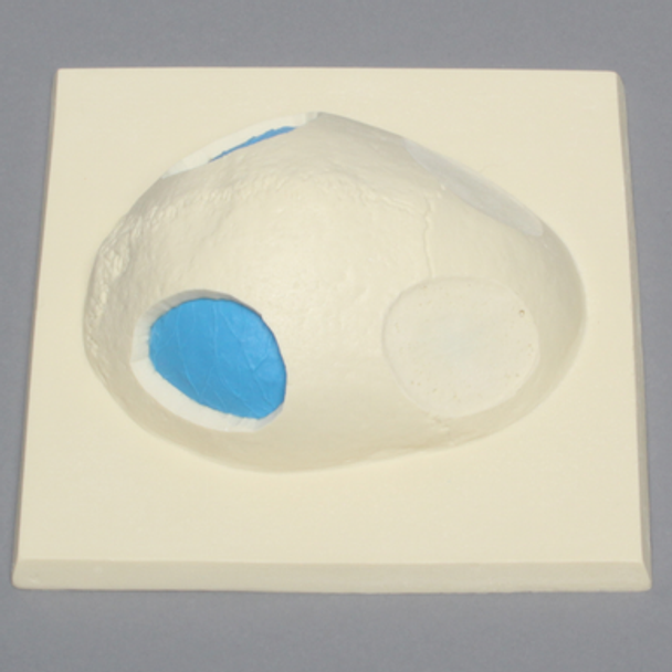 Skull Cap with Dura and Osteotomies