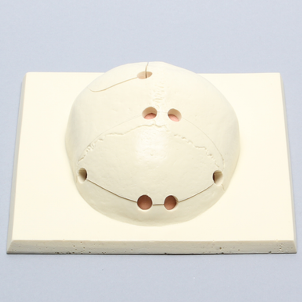 Skull Cap with Craniotomies