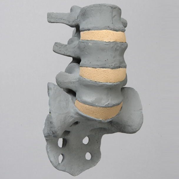 Spine, Lumbar, L3-Sacrum, Radiopaque
