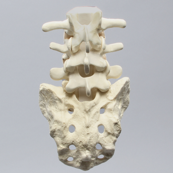 Spine, Lumbar with Bilateral Ligaments, L3-Sacrum, Solid Foam