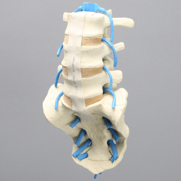 Spine, Lumbar with Nerve Roots, L3-Sacrum, Foam Cortical