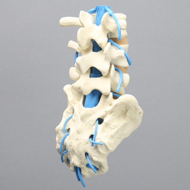 Spine, Lumbar with Nerve Roots, L3-Sacrum, Foam Cortical